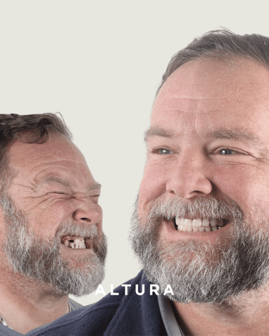 I-X-AC-FACE-EVANS, BRETT (1)