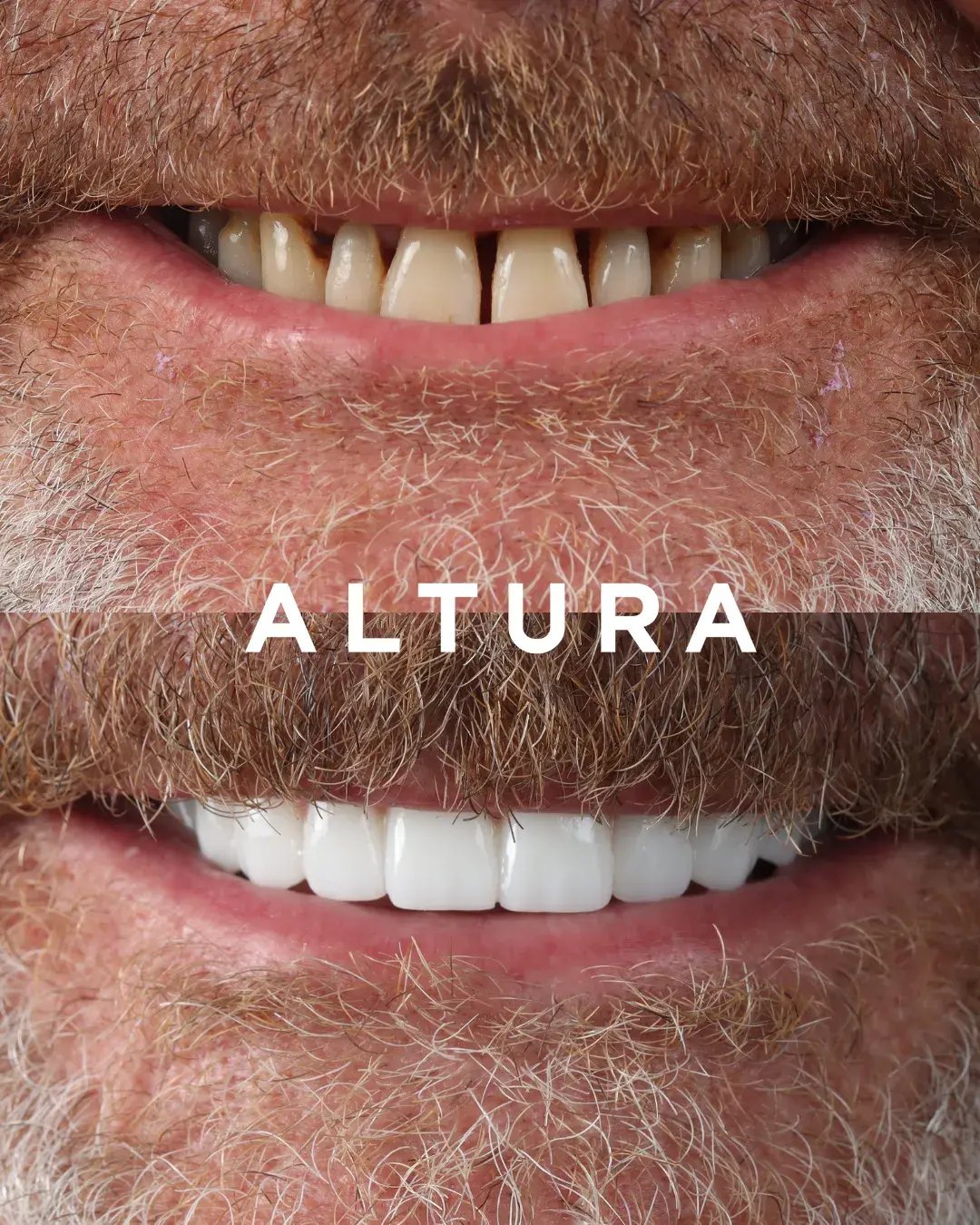 teeth 1