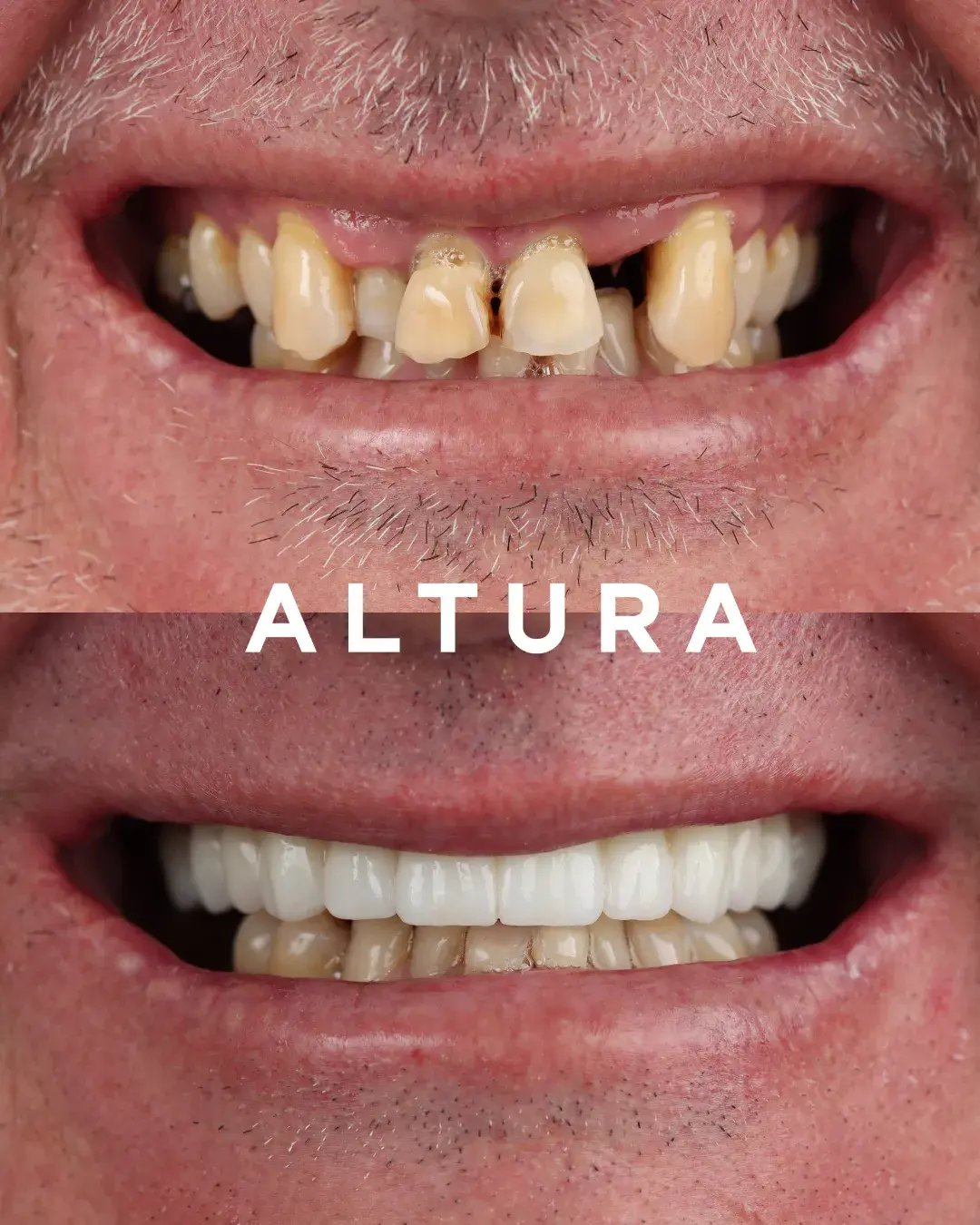 teeth 10