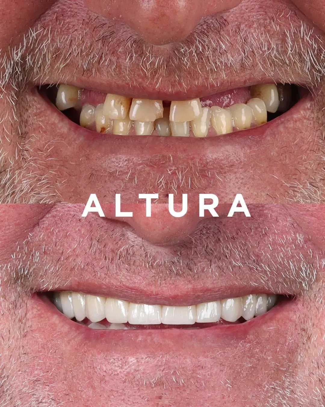 teeth 2