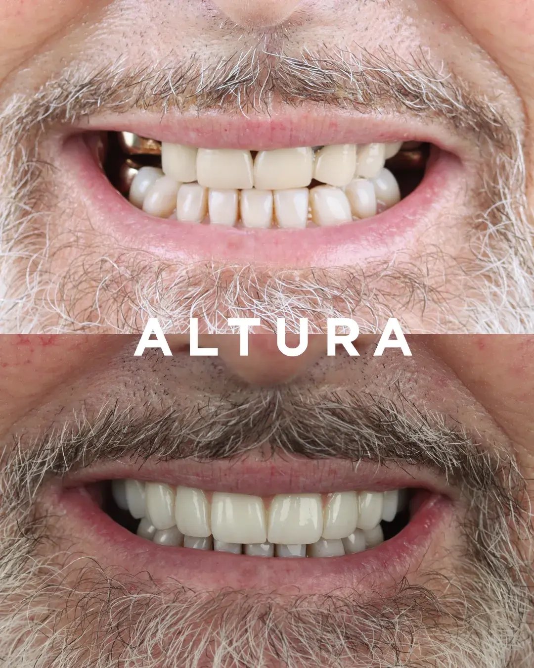 teeth 3