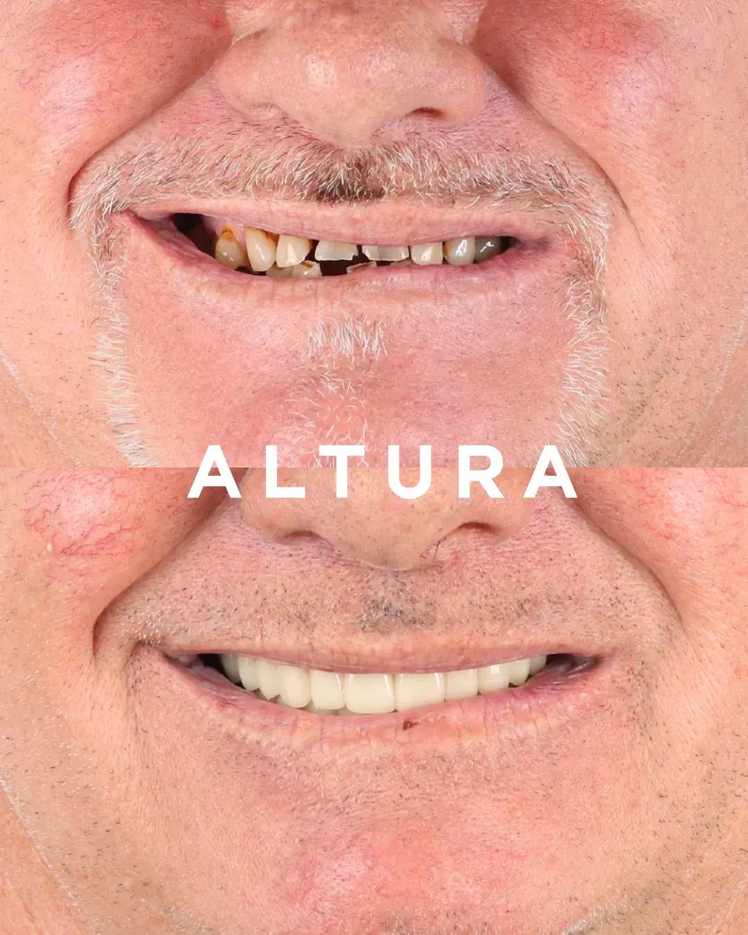 teeth 7