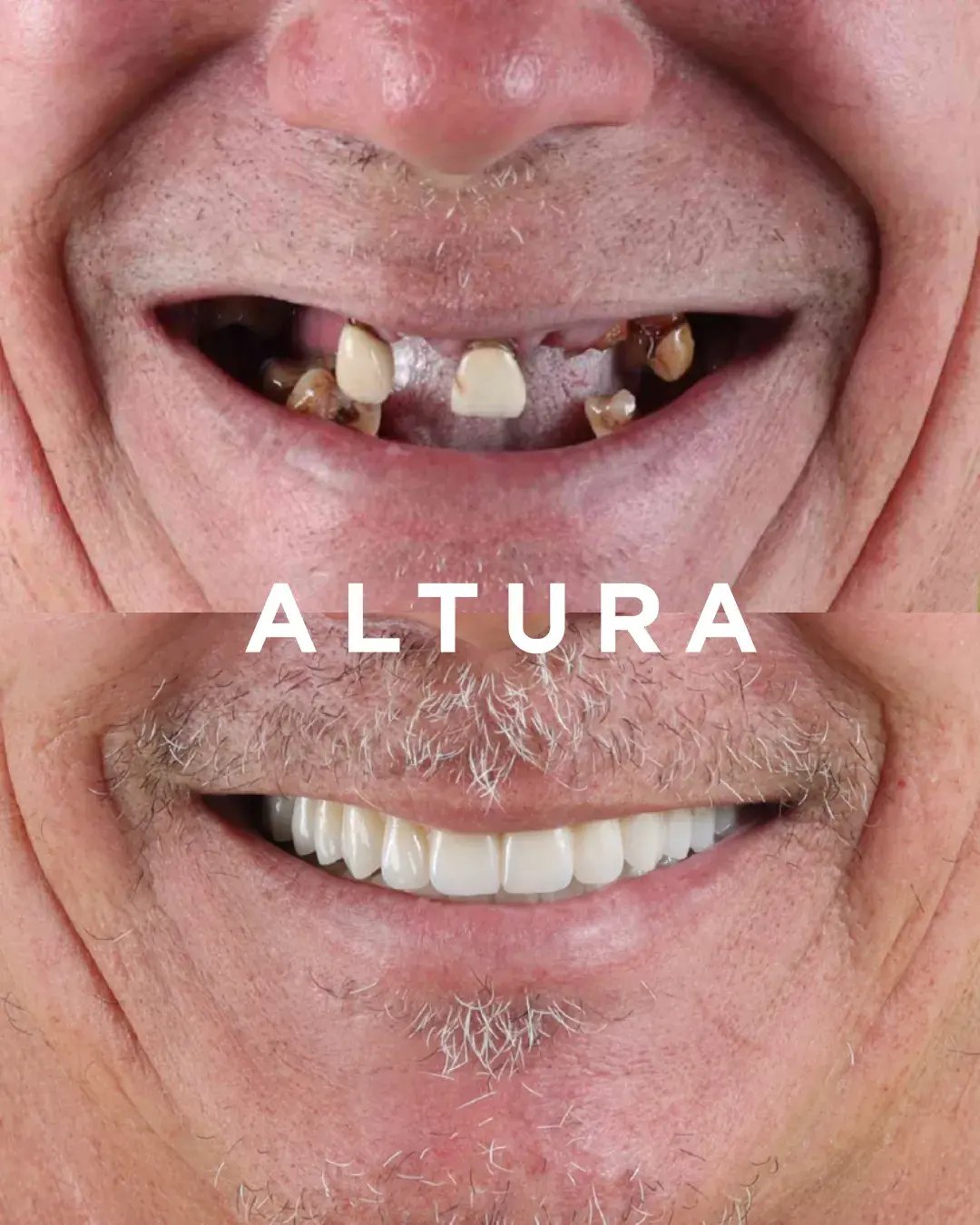 teeth 8
