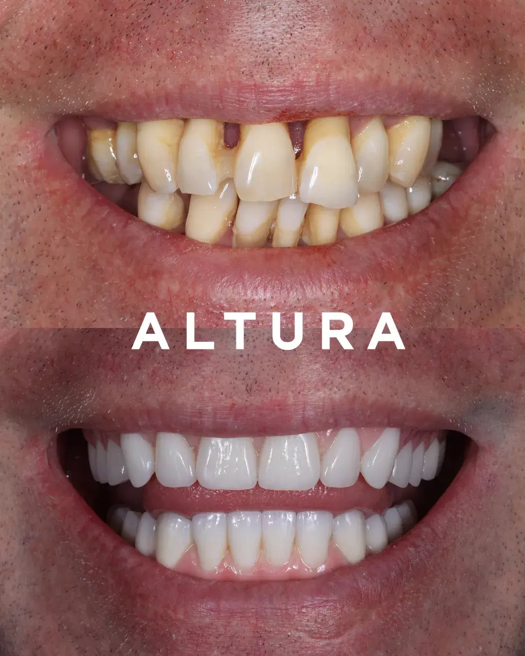 teeth 9