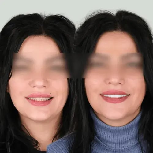 tmpojuhh2n0